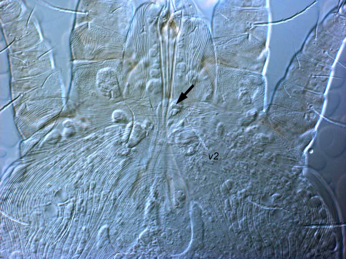            Fig. 5.   Capedulia prasadi  adult female   prodorsum (arrow indicates anterior margin of   prodorsum).   