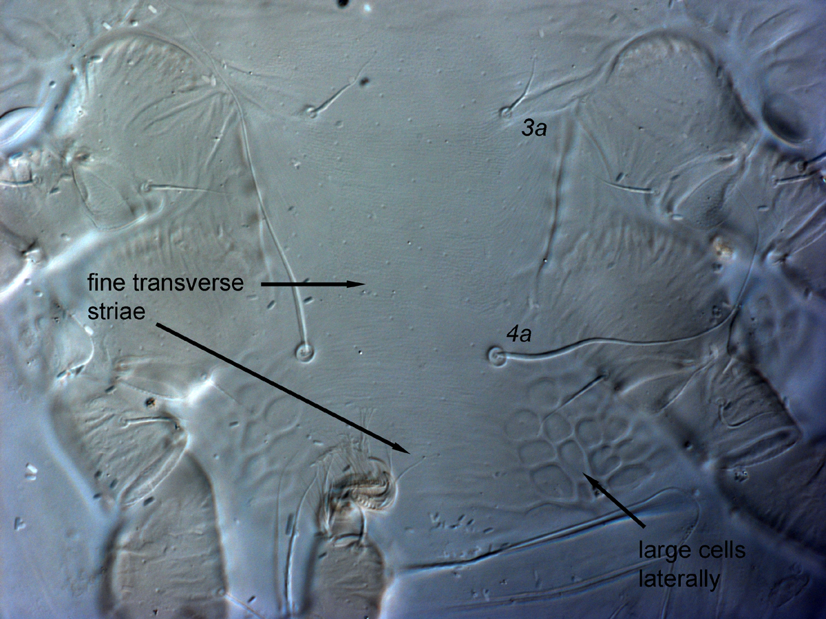  Fig. 11.  Cenopalpus lanceolatisetae  adult female venter between legs III and IV.

