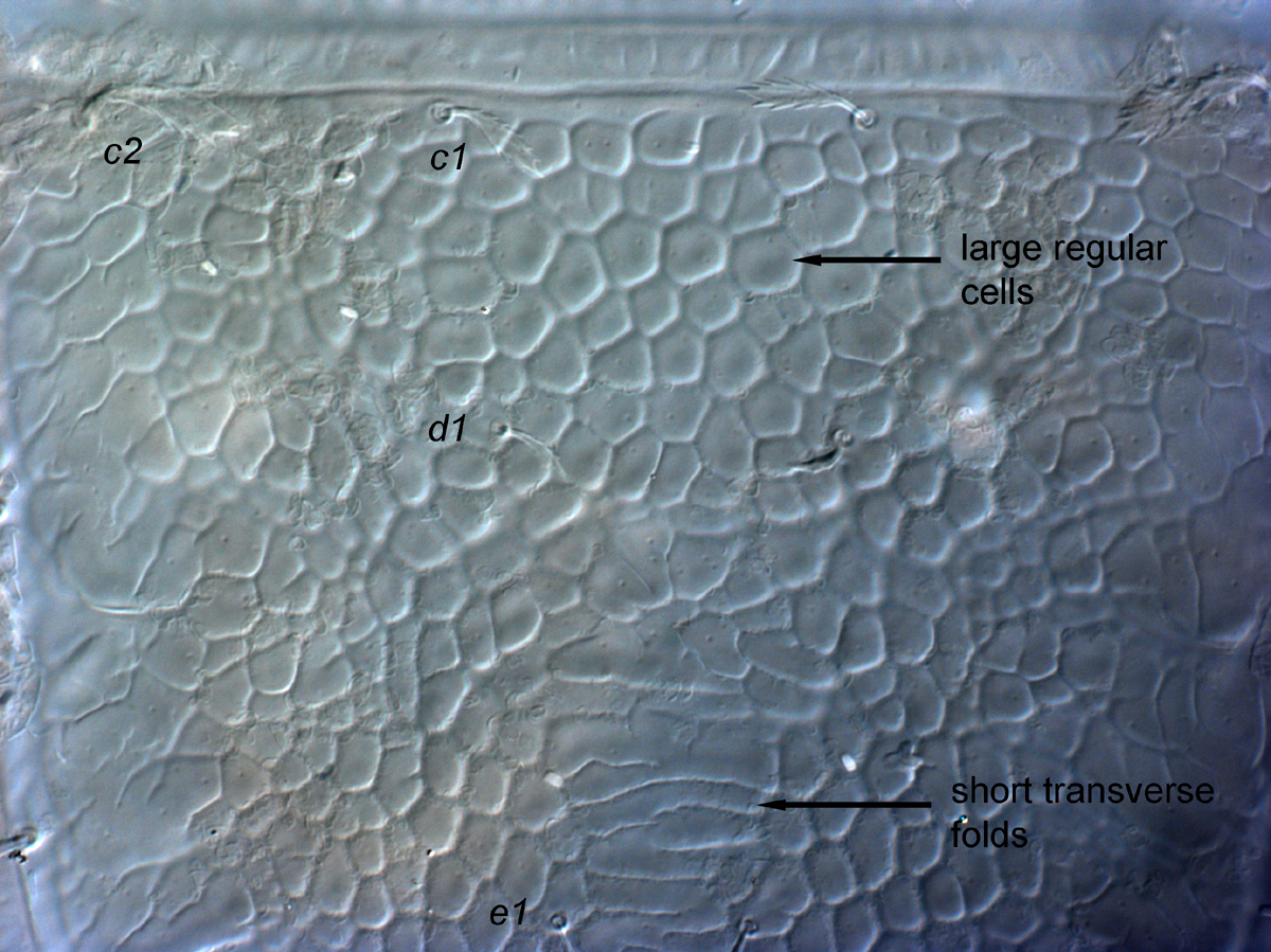  Fig. 5.  Cenopalpus lanceolatisetae  adult female anterior dorsal opisthosoma.
