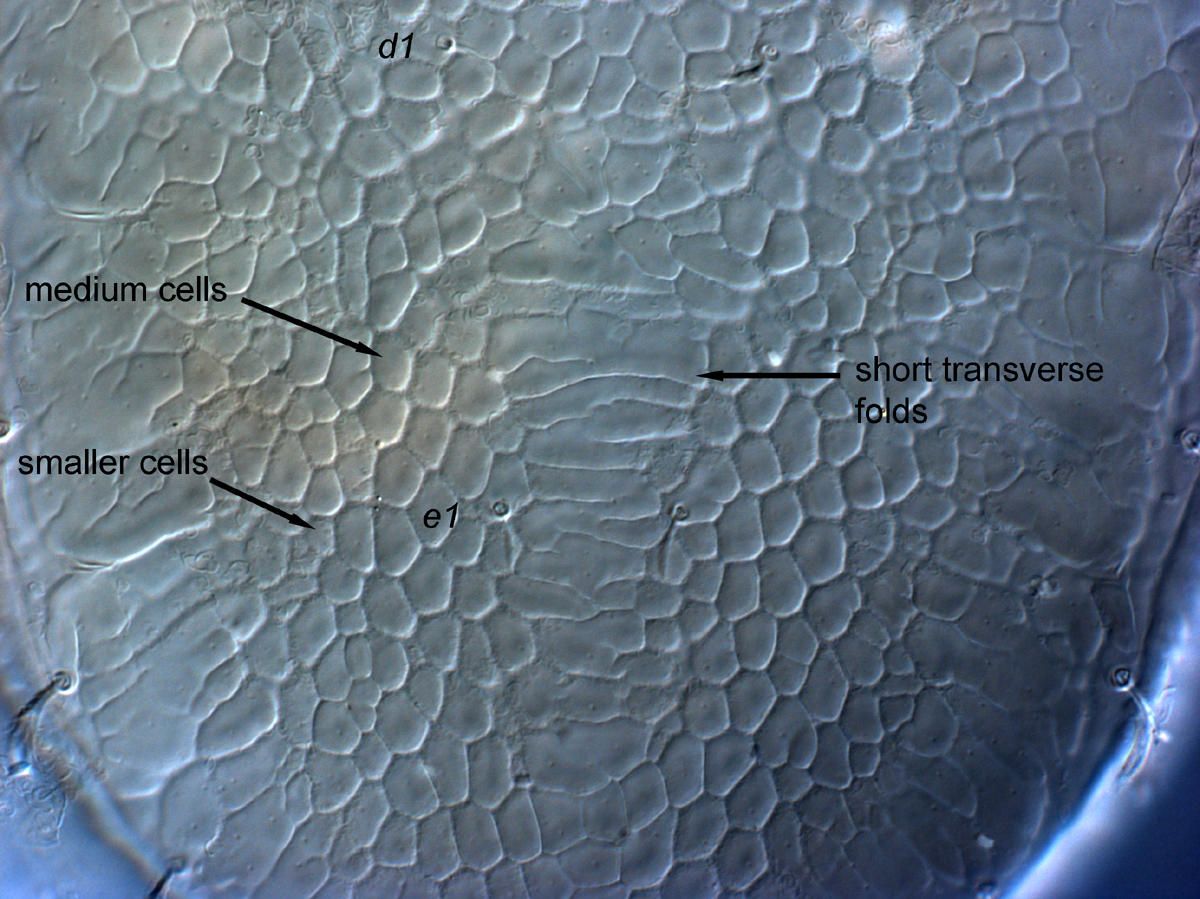  Fig. 7.  Cenopalpus lanceolatisetae  adult female dorsal opisthosoma between setae  d1  and  e1 .
