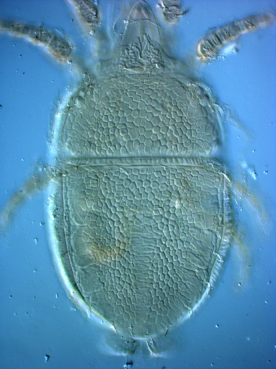  Fig. 1.  Cenopalpus lanceolatisetae  adult female dorsum.
