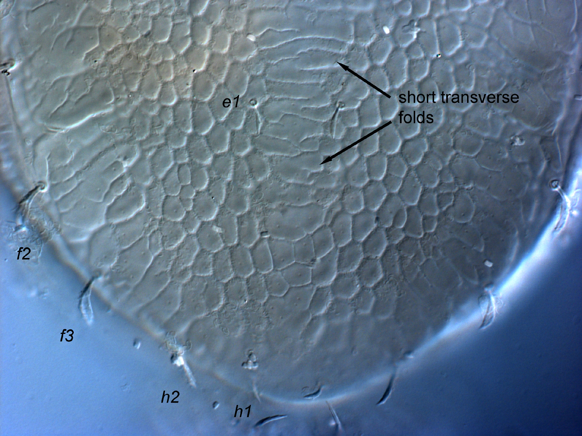  Fig. 9.  Cenopalpus lanceolatisetae  adult female posterior dorsal opisthosoma.
