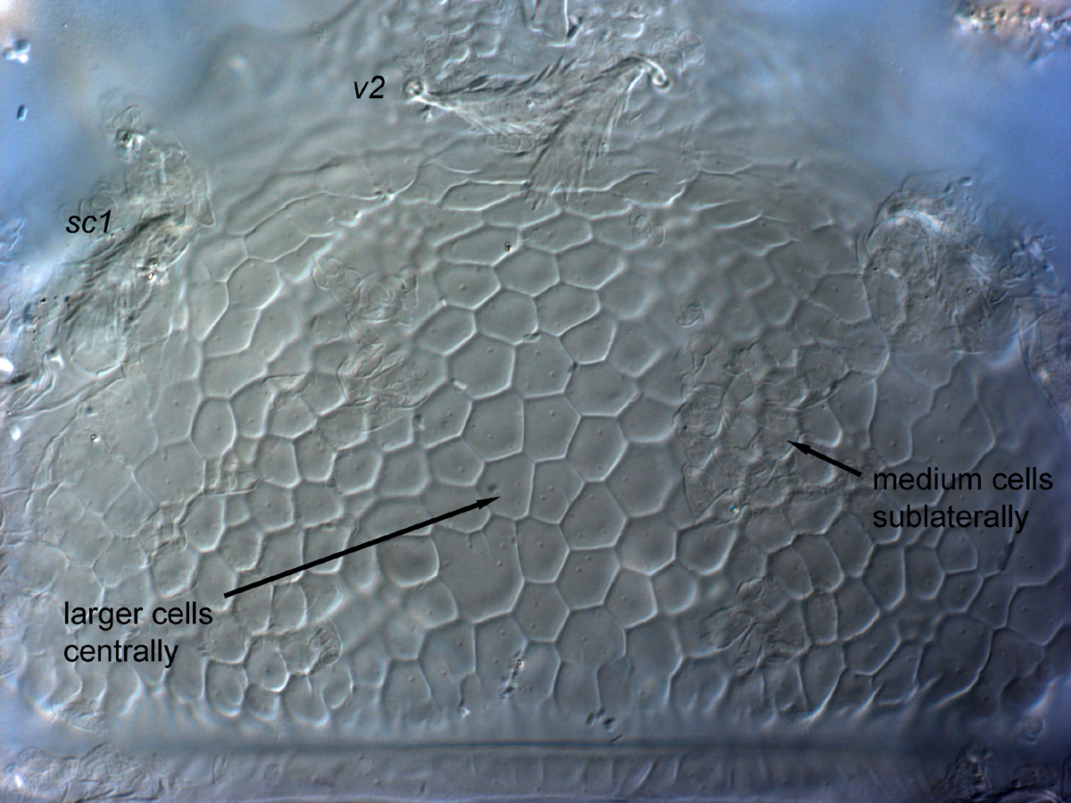  Fig. 3.  Cenopalpus lanceolatisetae  adult female prodorsum.
