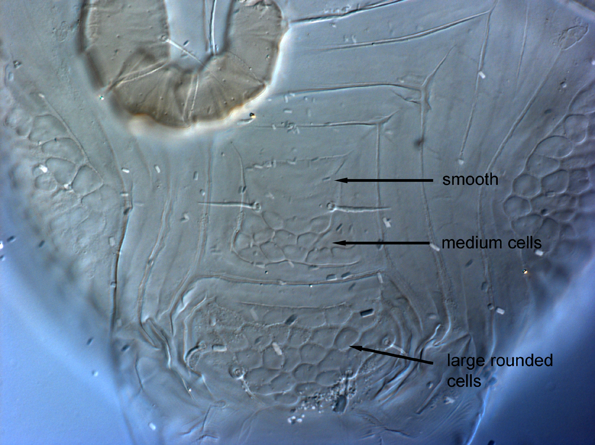  Fig. 13.  Cenopalpus lanceolatisetae  adult female posterior venter.
