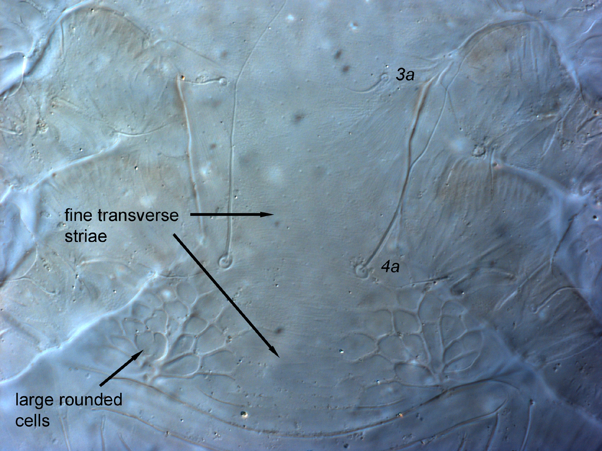  Fig. 12.  Cenopalpus lanceolatisetae  adult female venter between legs III and IV.
