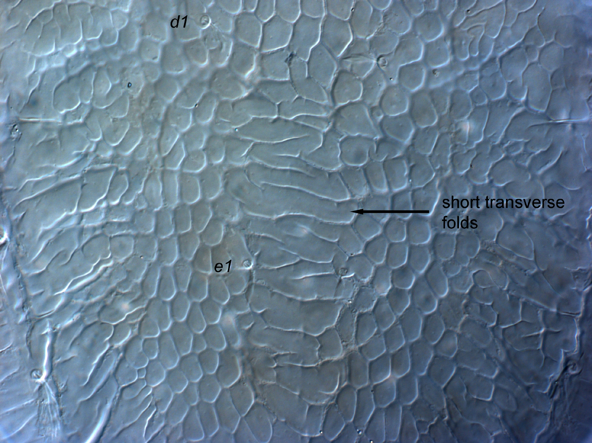  Fig. 8.  Cenopalpus lanceolatisetae  adult female dorsal opisthosoma between setae  d1  and  e1 .
