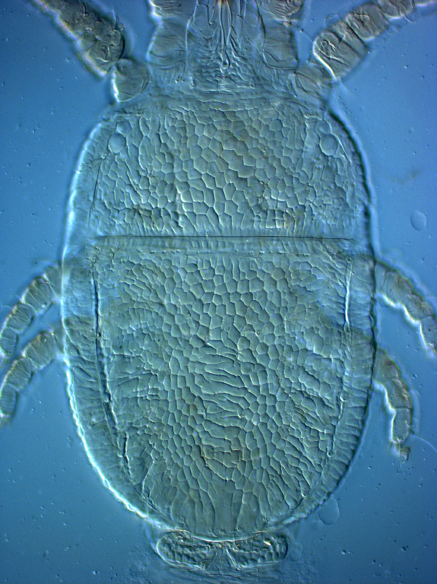  Fig. 2.  Cenopalpus lanceolatisetae  adult female dorsum.
