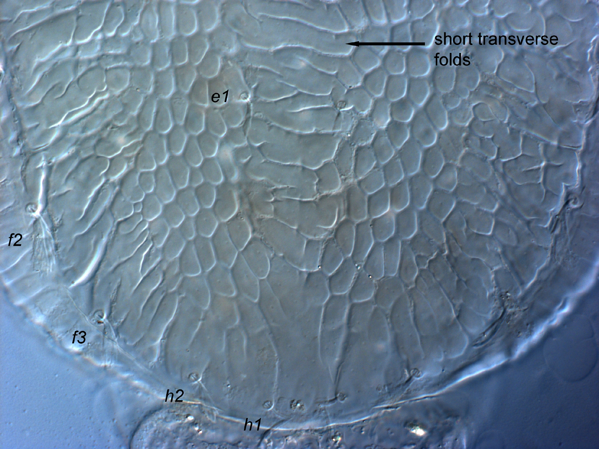 Fig. 10.  Cenopalpus lanceolatisetae  adult female posterior dorsal opisthosoma.

