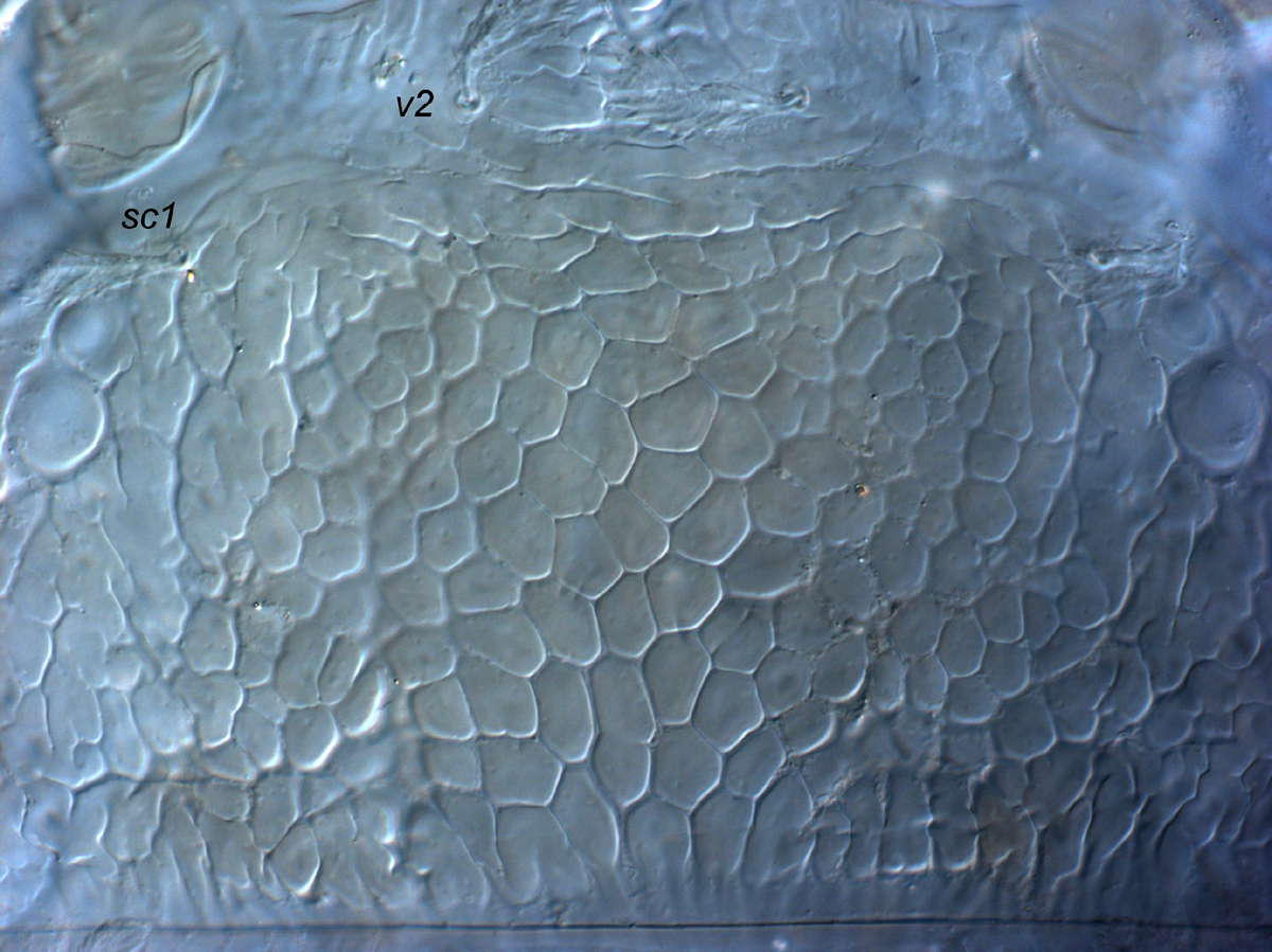  Fig. 4.  Cenopalpus lanceolatisetae  adult female prodorsum.
