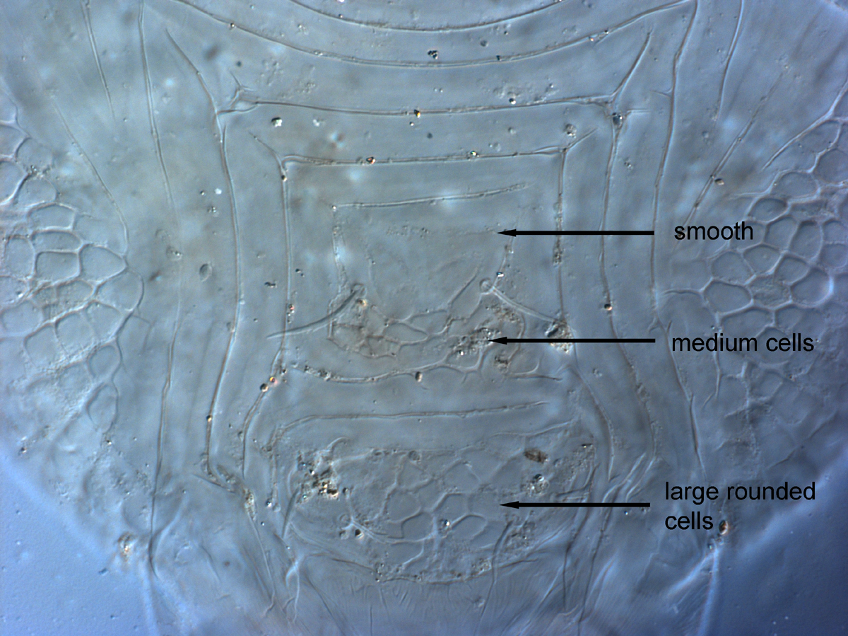  Fig. 14.  Cenopalpus lanceolatisetae  adult female posterior venter.
