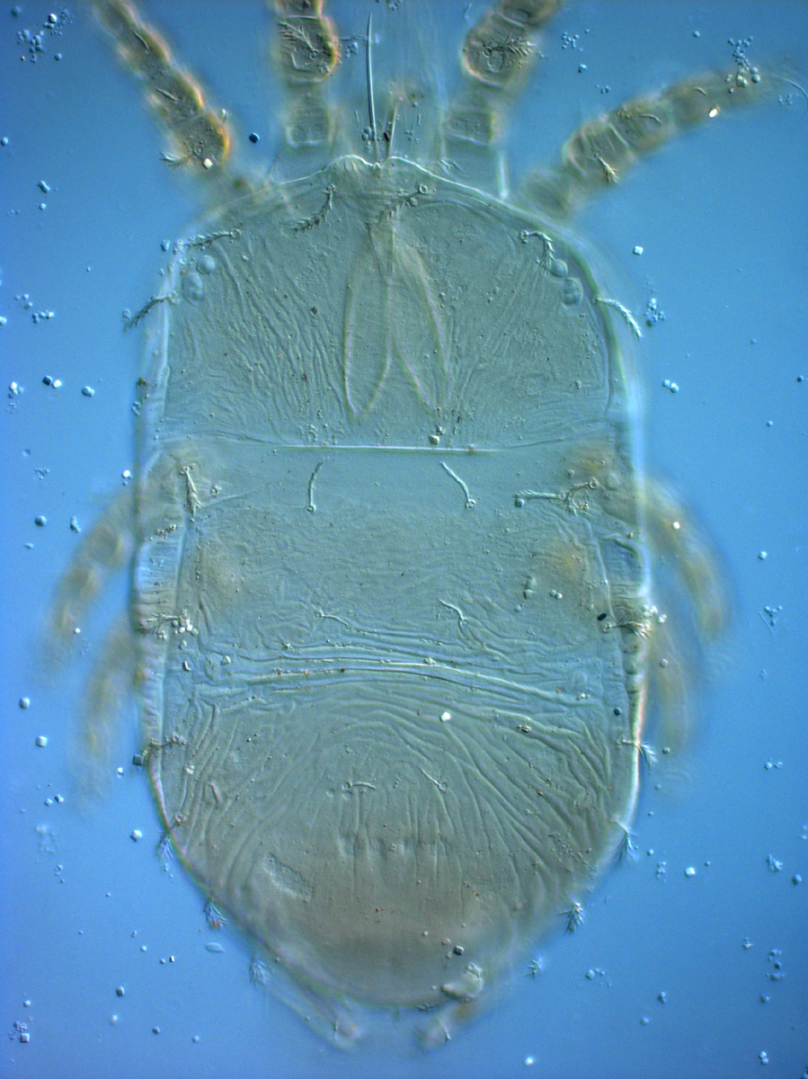            Fig. 11.   Cenopalpus  nr  C.   lineola  female dorsum, with mostly smooth dorsal   cuticle.   