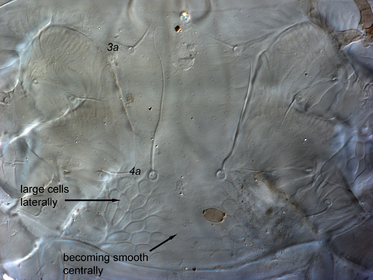  Fig. 11.  Cenopalpus pulcher  adult female venter, with smooth central cuticle between  4a  and ventral plate.
