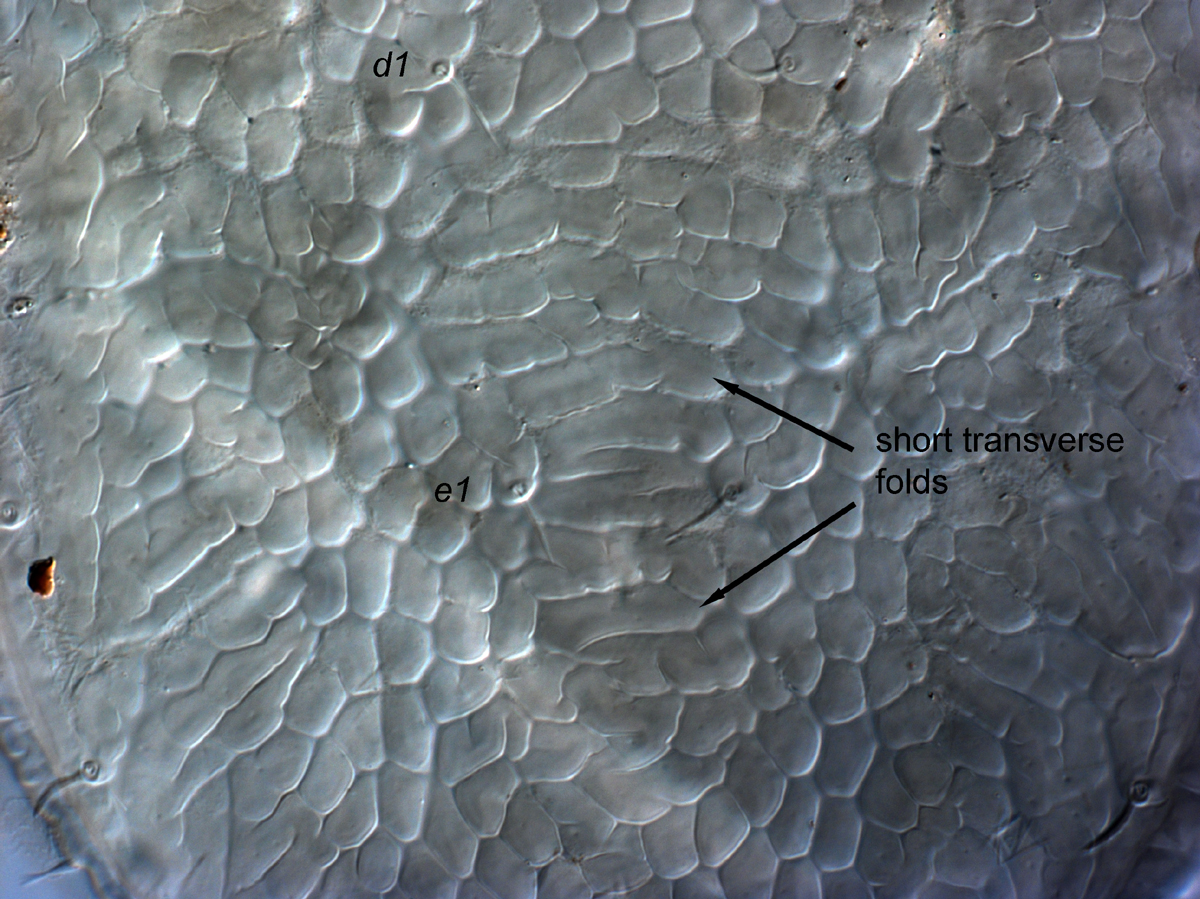   Fig. 7.  Cenopalpus pulcher  adult female posterior dorsal opisthosoma.
