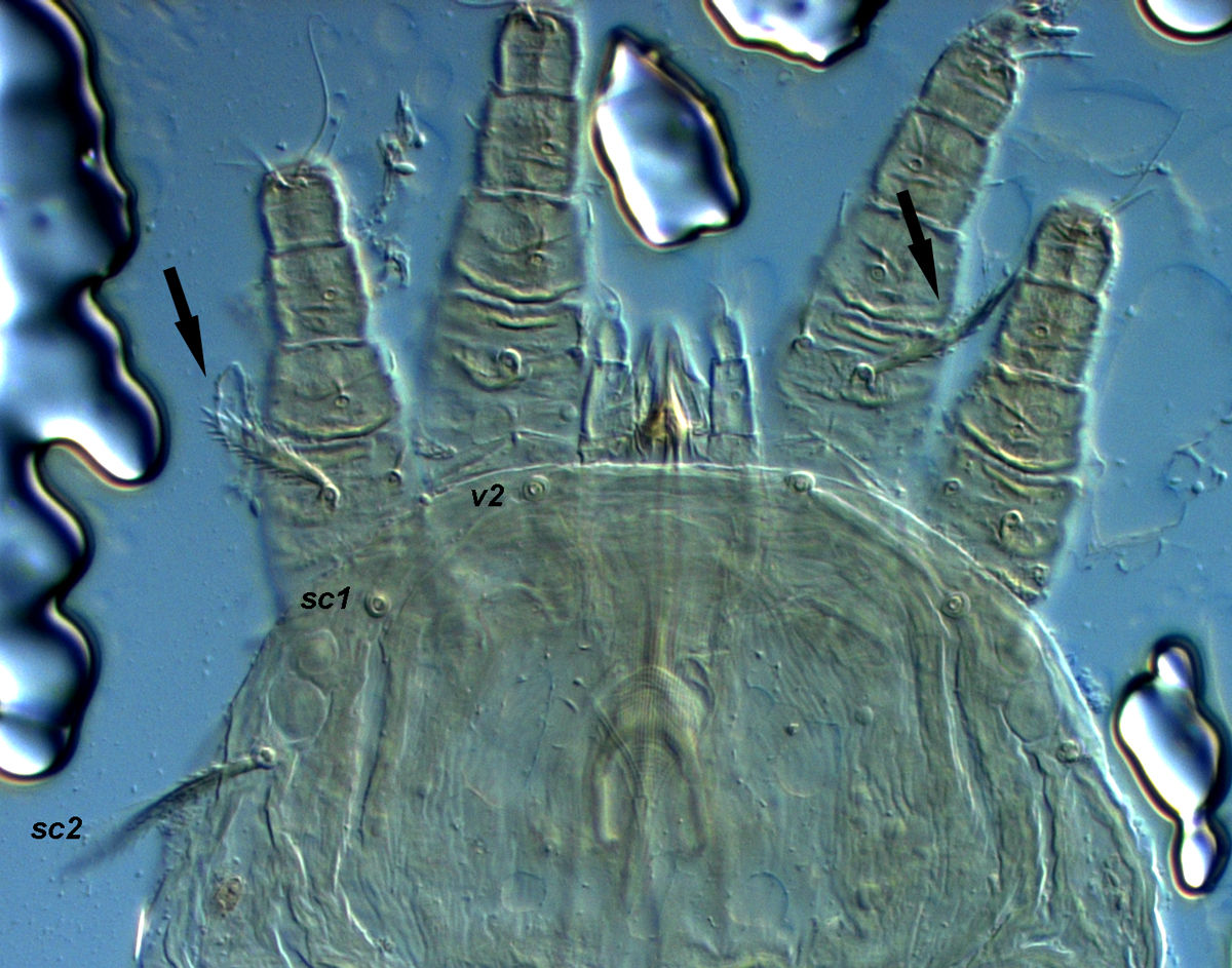  Fig. 21.  Cenopalpus pulcher  deutonymph prodorsum and legs, indicating large barbed setae on femora I-II (see arrows) (n.b. setae  v2  and  sc1  are broken).
