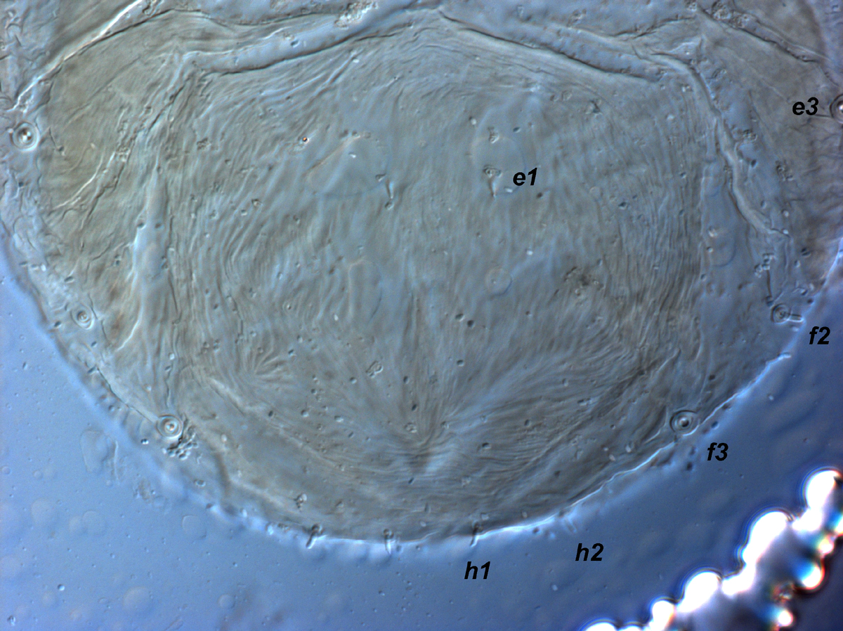  Fig. 20.  Cenopalpus pulcher  deutonymph posterior dorsum, indicating minute setae  e1 ,  f2 ,  h1 ,  h2  (n.b. setae  e3  and  f3  are broken).
