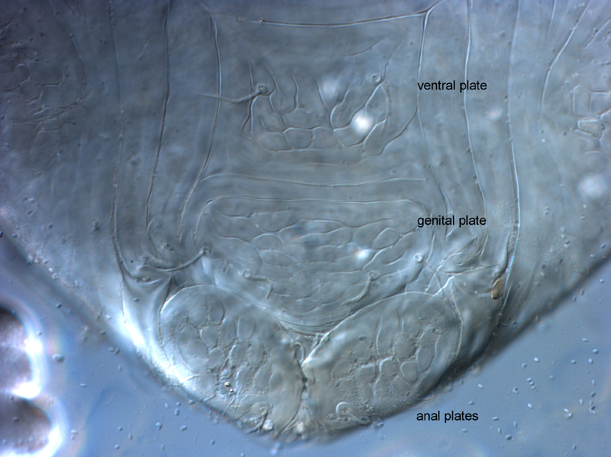            Fig. 9.   Cenopalpus pulcher  female   posterior venter, indicating well developed plates.   