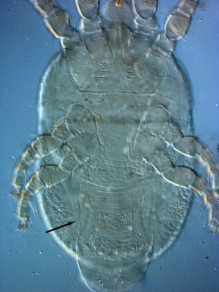            Fig. 7.   Cenopalpus pulcher  female   venter - note characterisitc cuticle surrounding ventral   plate.   