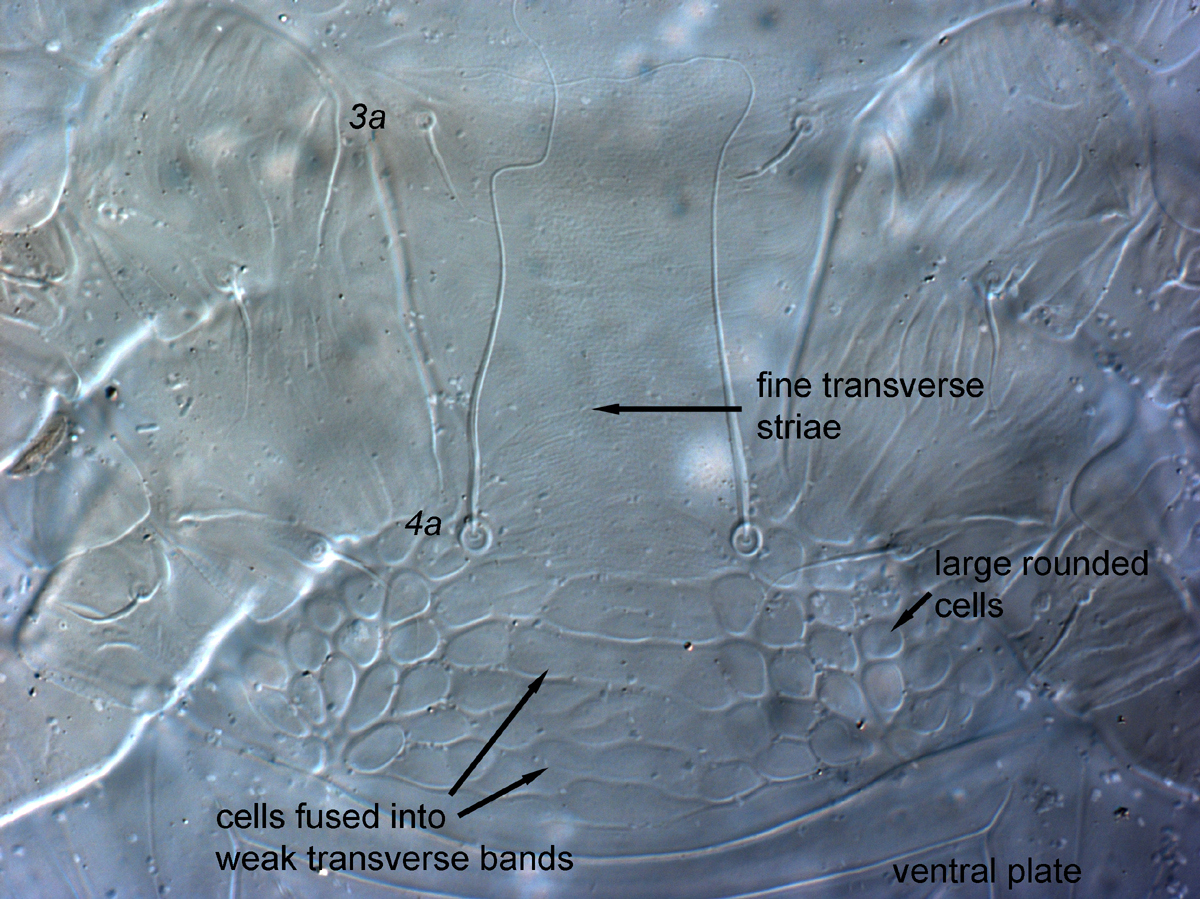  Fig. 10.  Cenopalpus pulcher  adult female venter, with large cells fusing to form weak transverse bands centrally.
