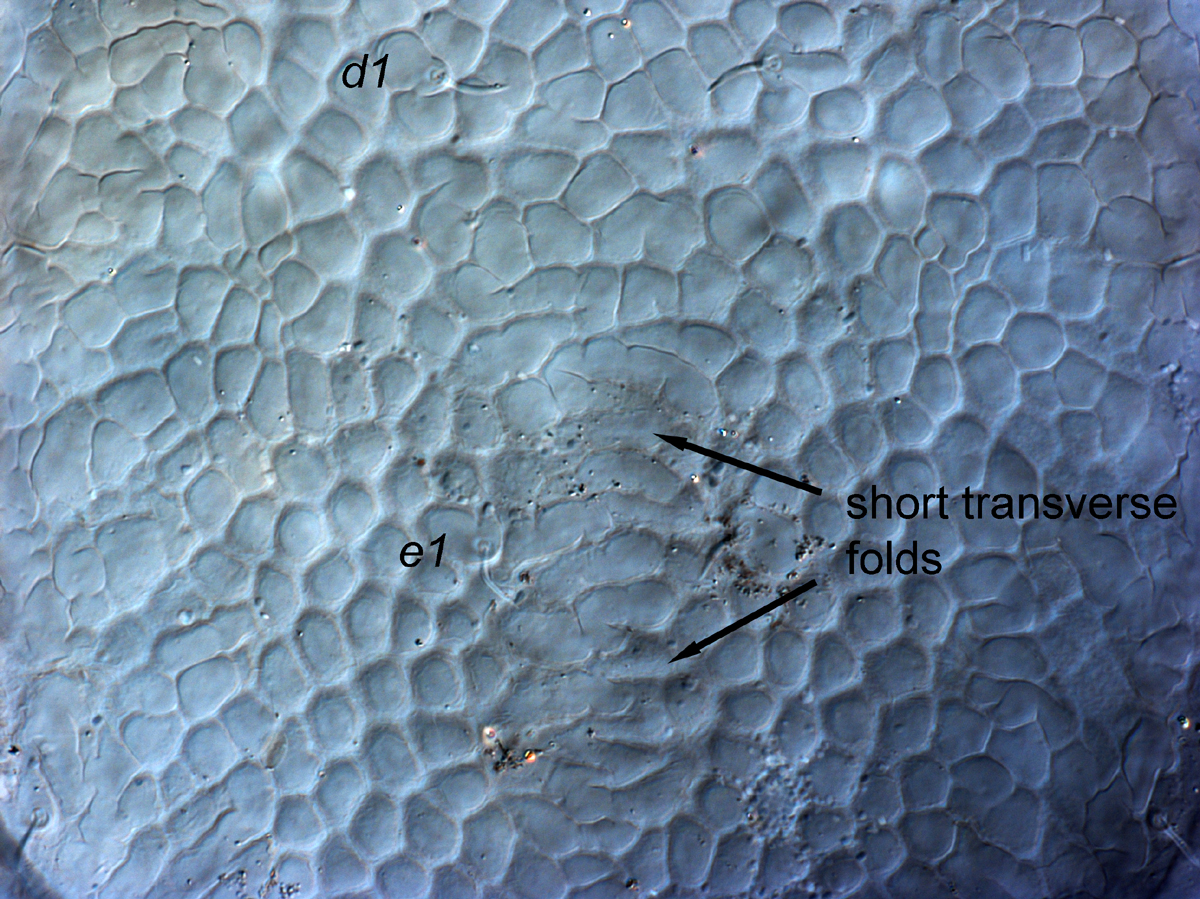  Fig. 6.  Cenopalpus pulcher  adult female dorsal opisthosoma between setae  d1  and  e1 .
