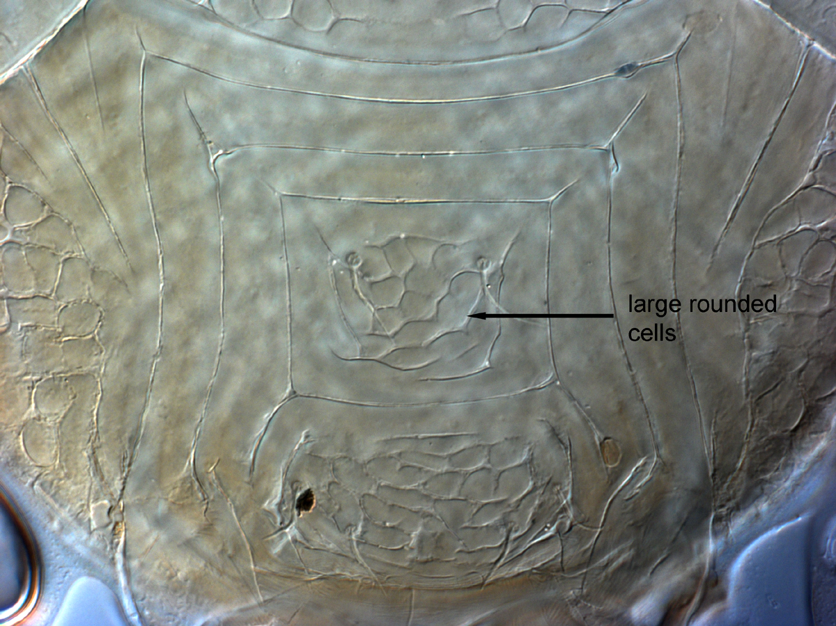  Fig. 13.  Cenopalpus pulcher  adult female posterior venter, with large rounded cells on ventral plate.
