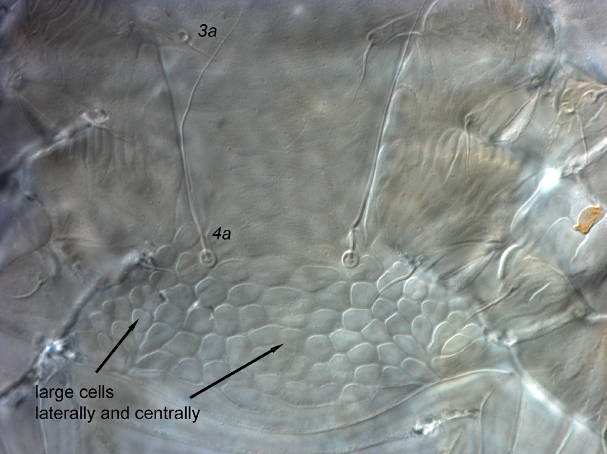  Fig. 9.  Cenopalpus pulcher  adult female venter, with large cells centrally between  4a  and ventral plate.
