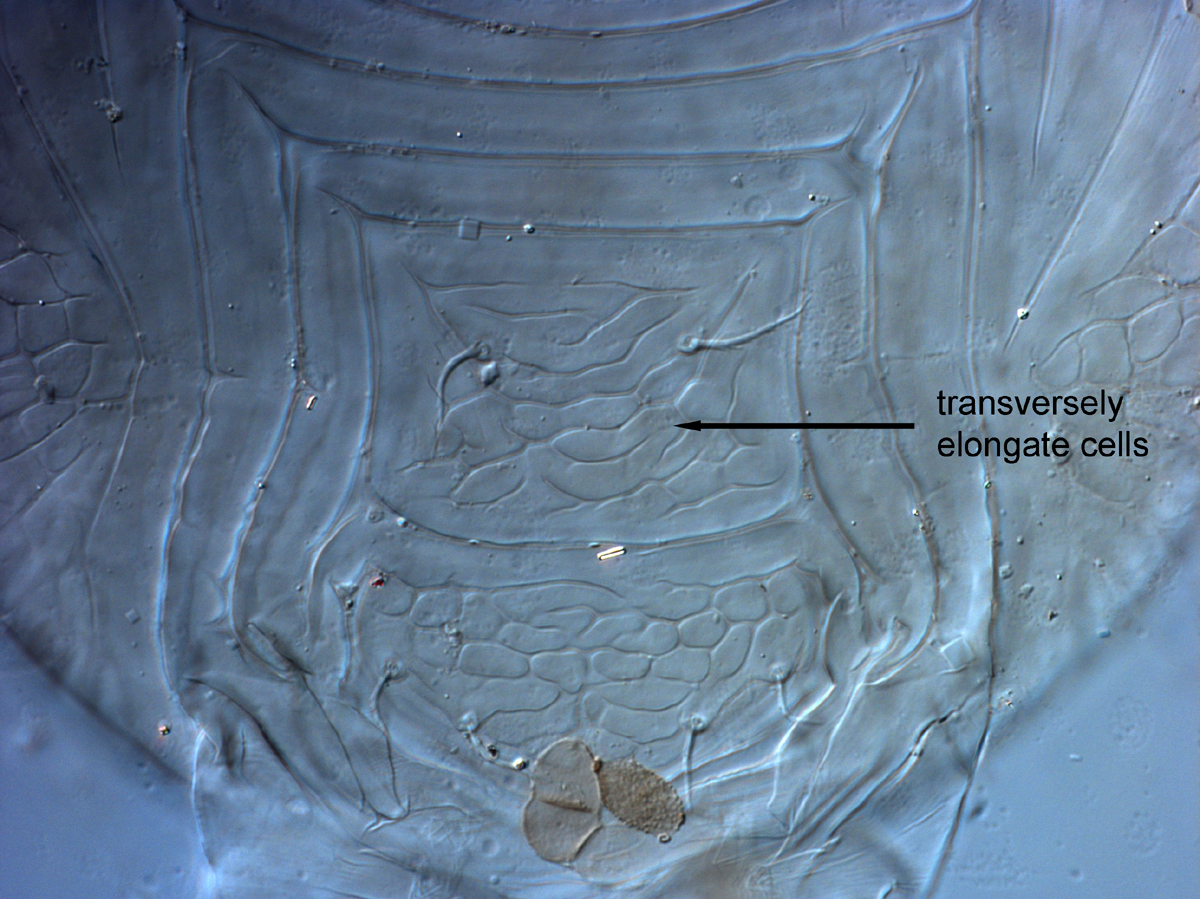  Fig. 15.  Cenopalpus pulcher  adult female posterior venter, with transversely elongate cells on ventral plate.
