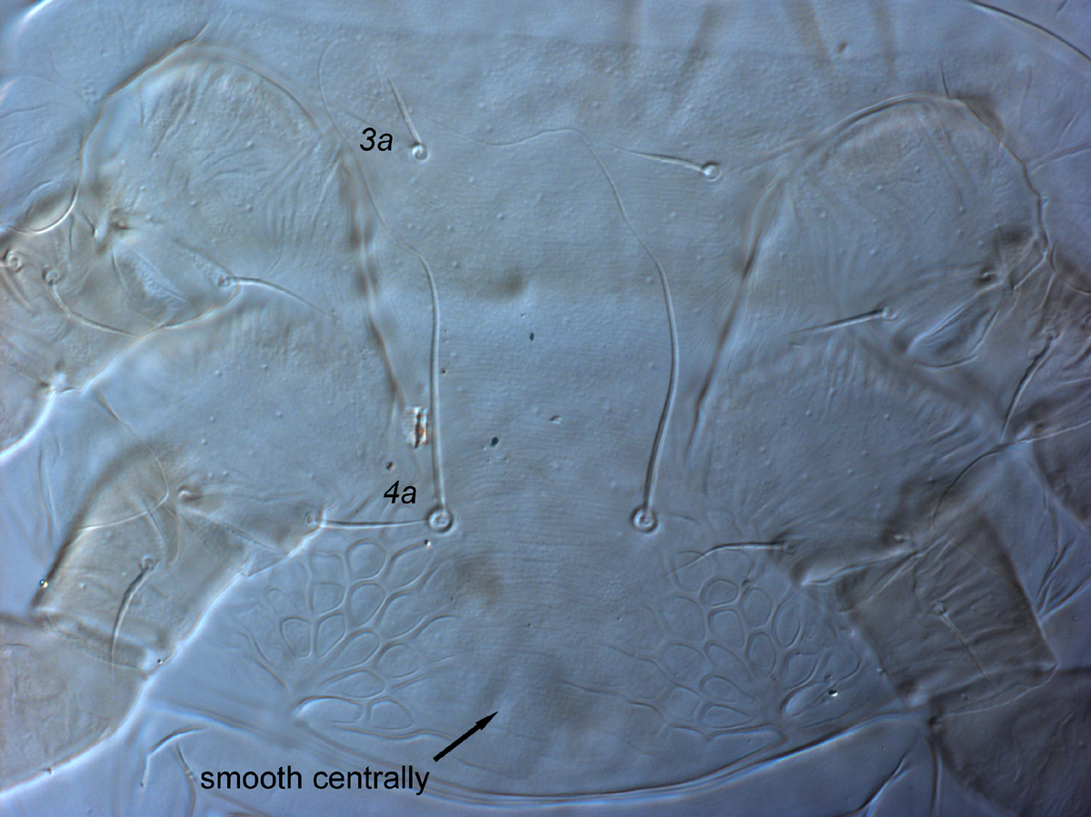  Fig. 12.  Cenopalpus pulcher  adult female venter, with smooth central cuticle between  4a  and ventral plate.
