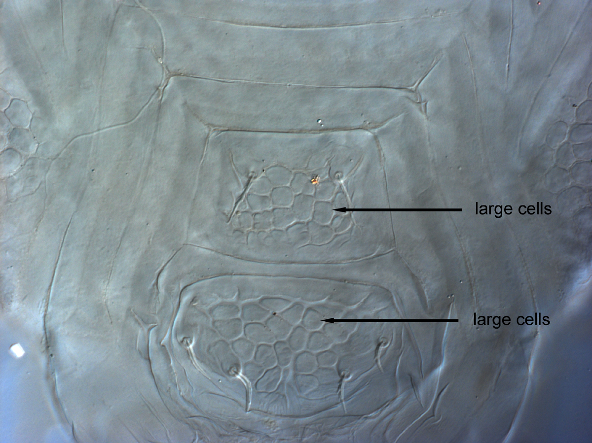  Fig. 10.  Cenopalpus spinosus  adult female posterior venter.
