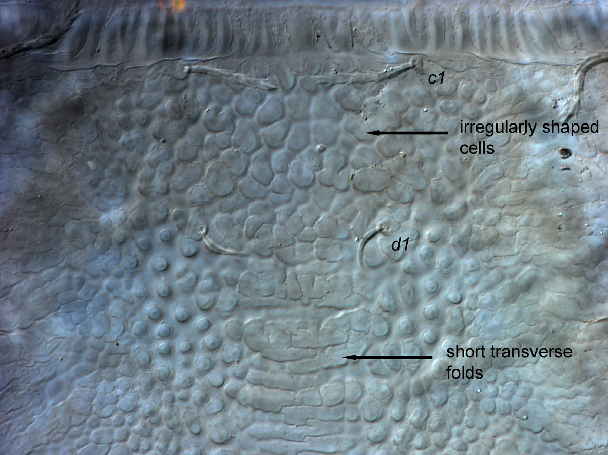  Fig. 5.  Cenopalpus spinosus  adult female anterior dorsal opisthosoma.
