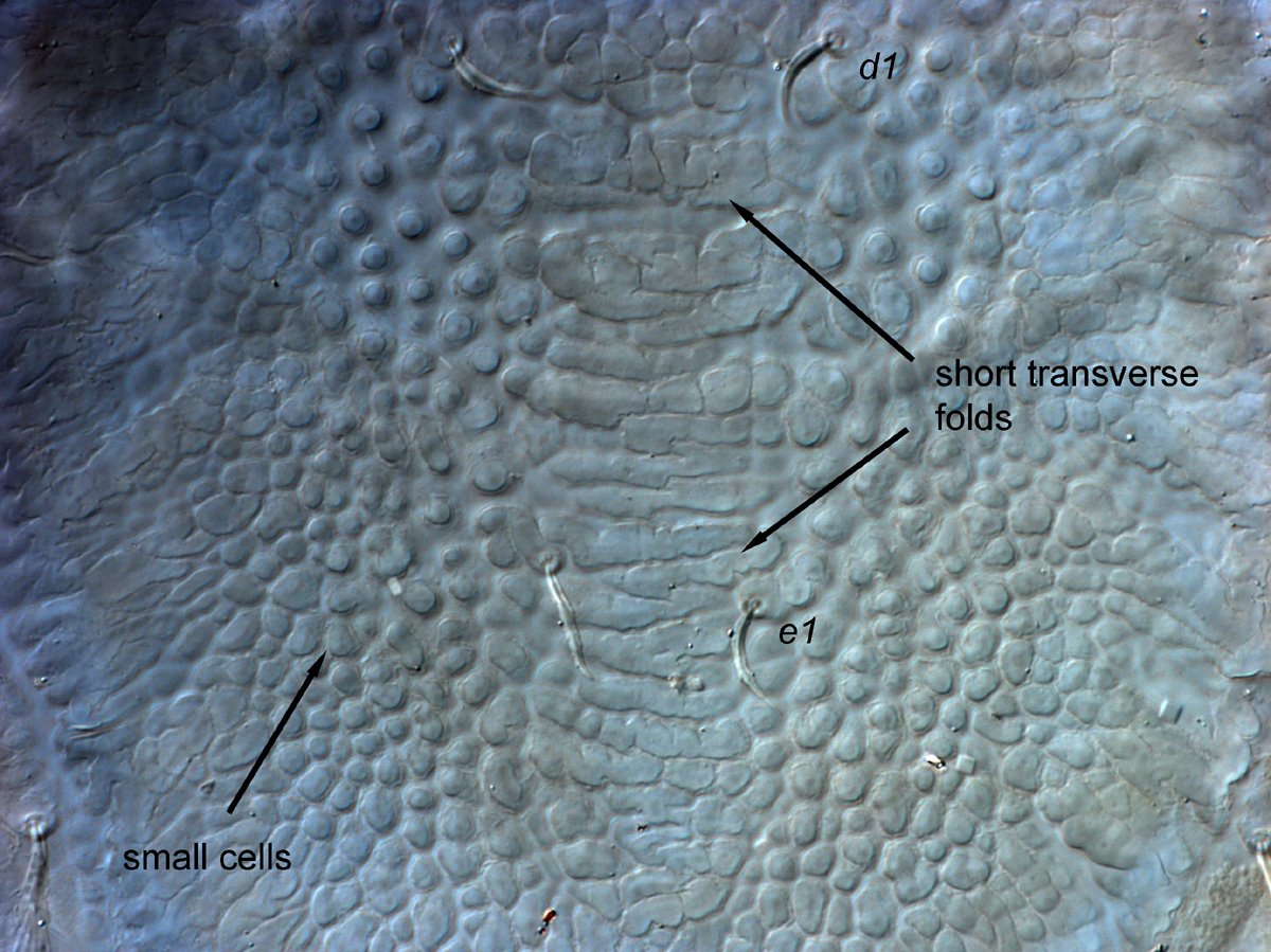  Fig. 6.  Cenopalpus spinosus  adult female dorsal opisthosoma between setae  d1  and  e1 .
