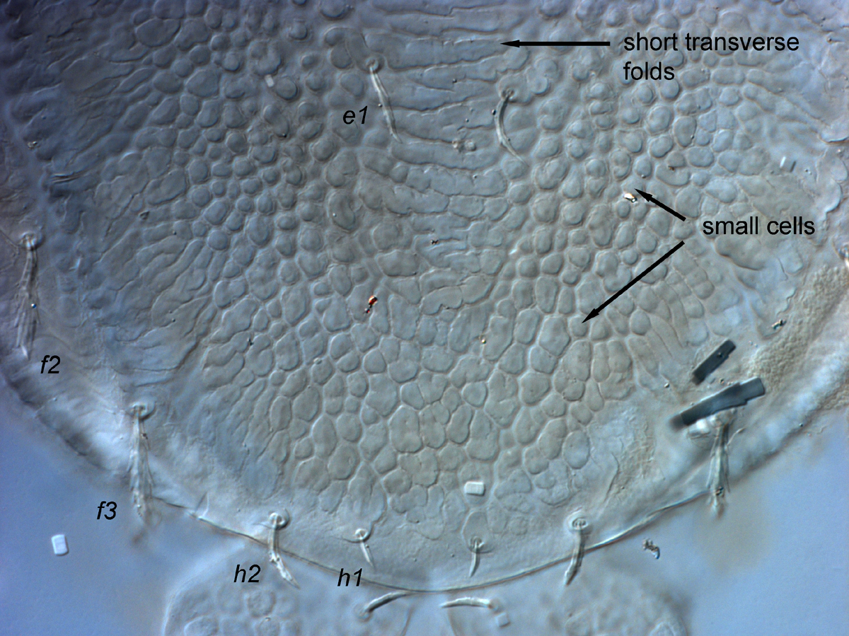  Fig. 7.  Cenopalpus spinosus  adult female posterior dorsal opisthosoma.
