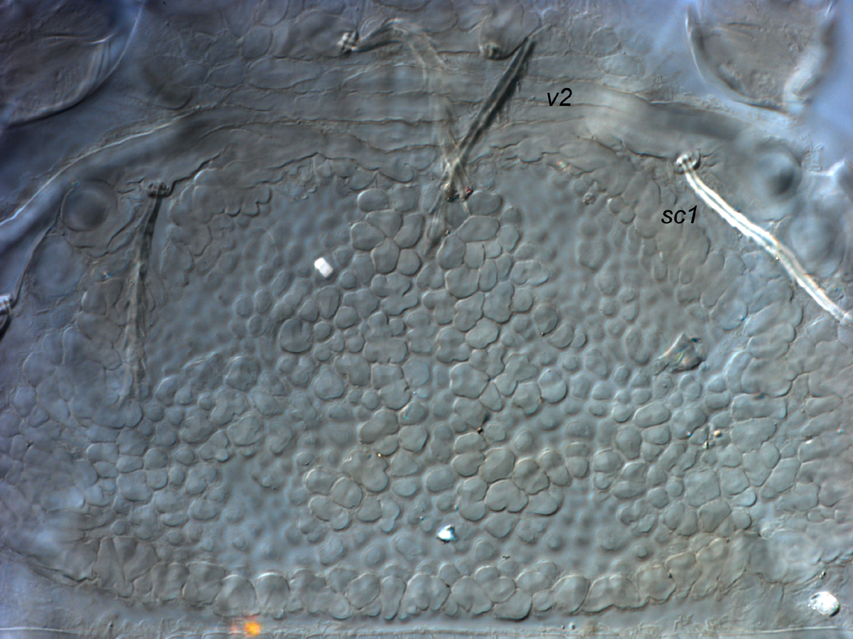  Fig. 4.  Cenopalpus spinosus  adult female prodorsum.
