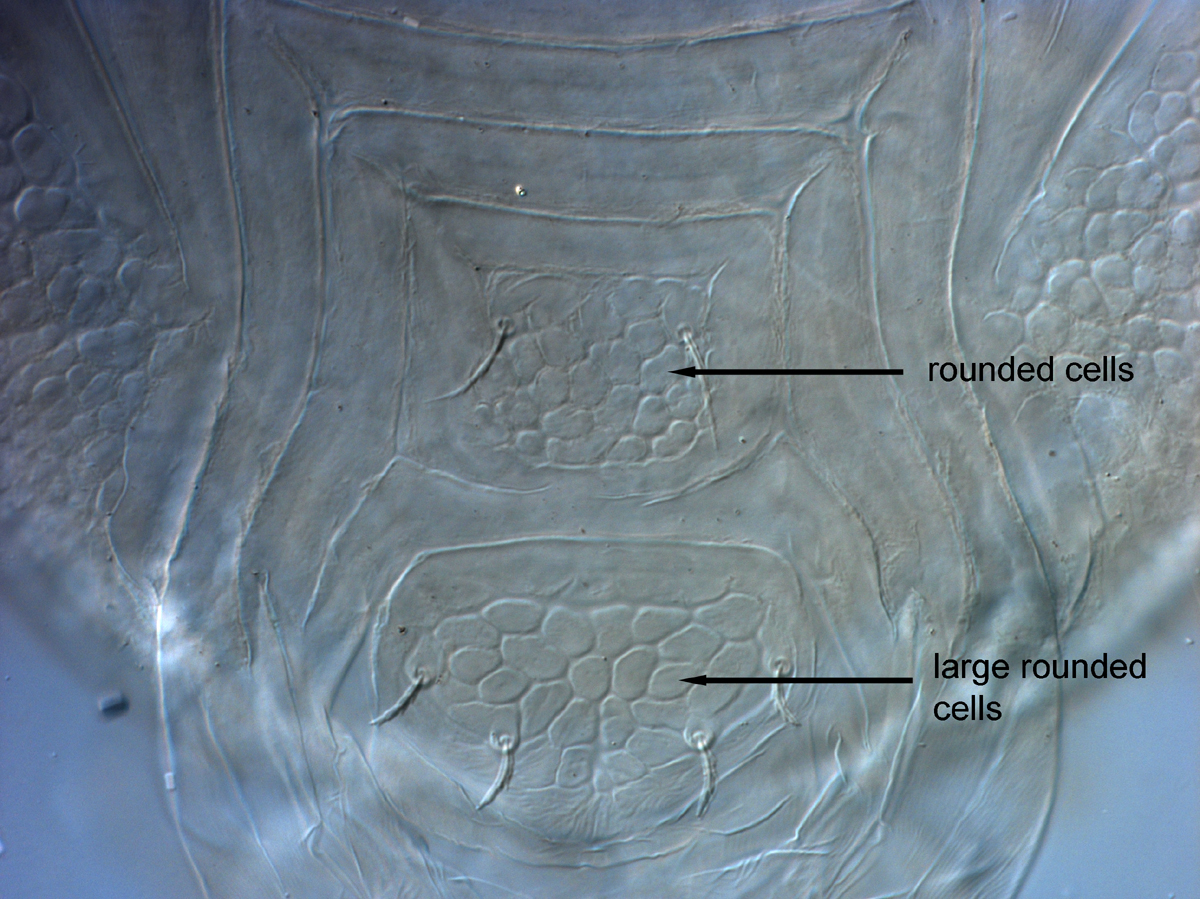 Fig. 9.  Cenopalpus spinosus  adult female posterior venter.
