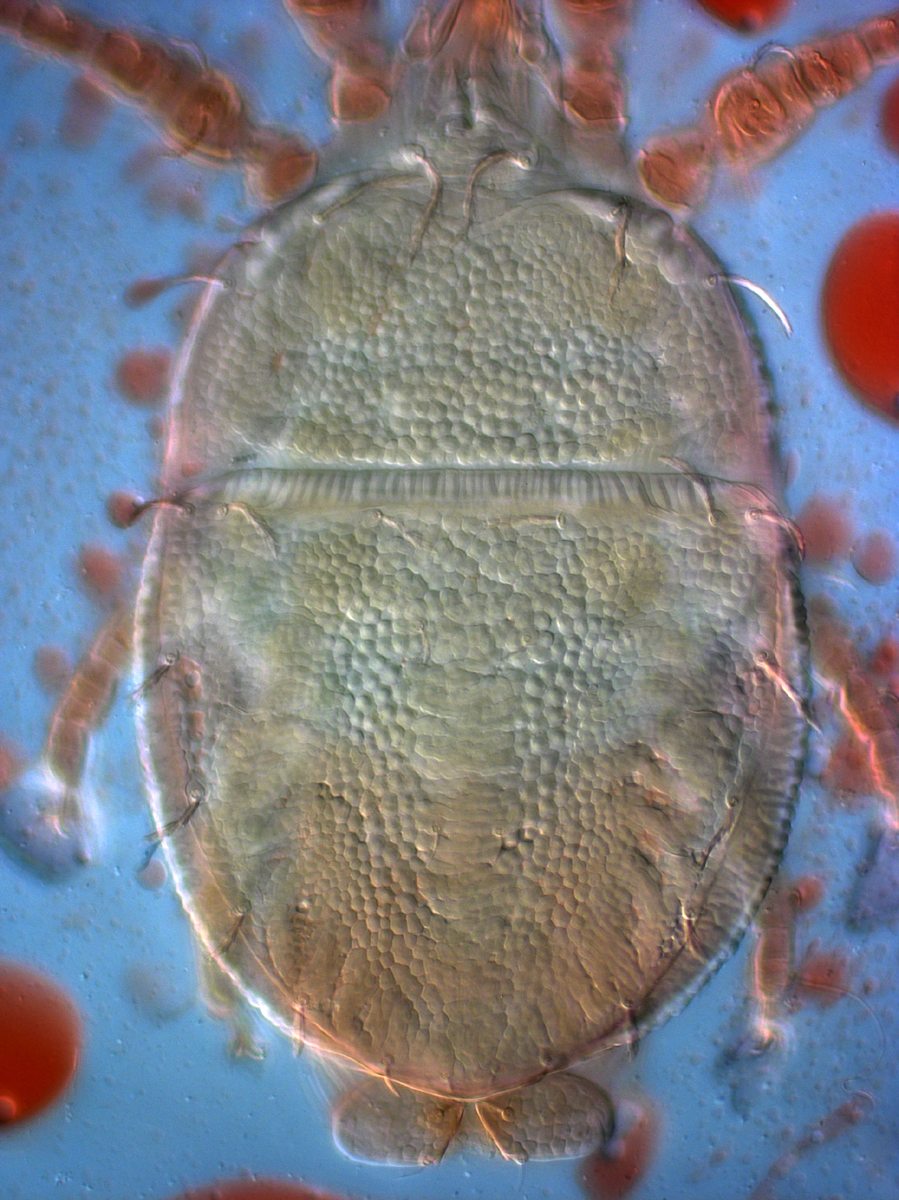  Fig. 2.  Cenopalpus spinosus  adult female dorsum
