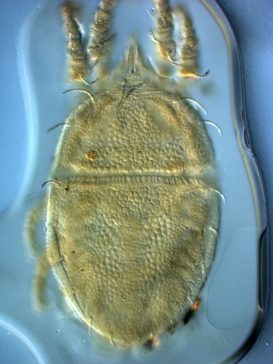  Fig. 3.  Cenopalpus spinosus  adult female dorsum.
