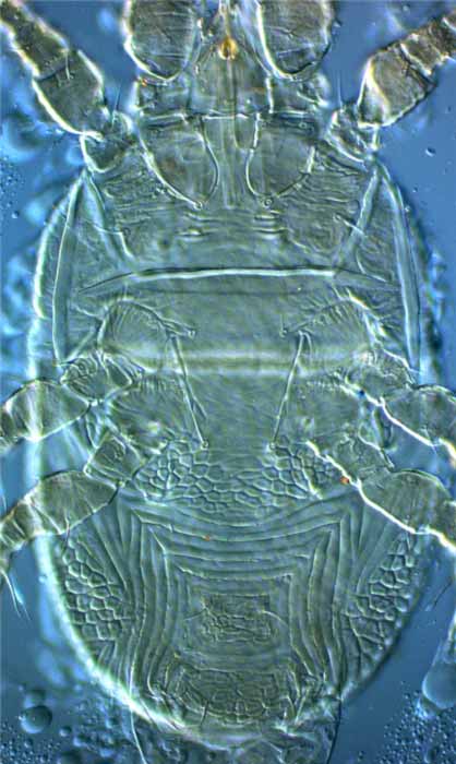            Fig. 8.   Cenopalpus pulcher  female   venter - note characterisitc cuticle surrounding ventral   plate.   