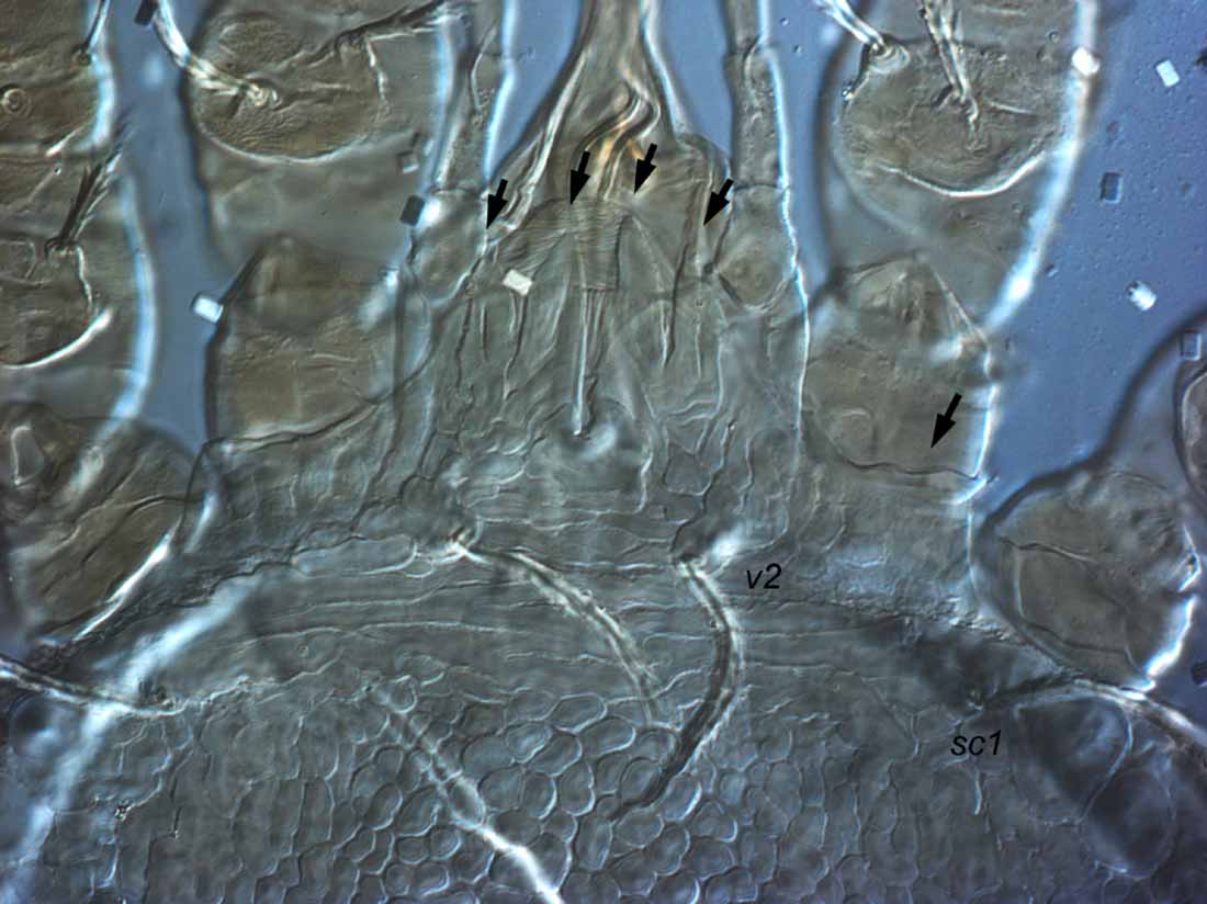            Fig. 5.   Cenopalpus spinosus  female prodorsal   projection (indicated by arrows).   