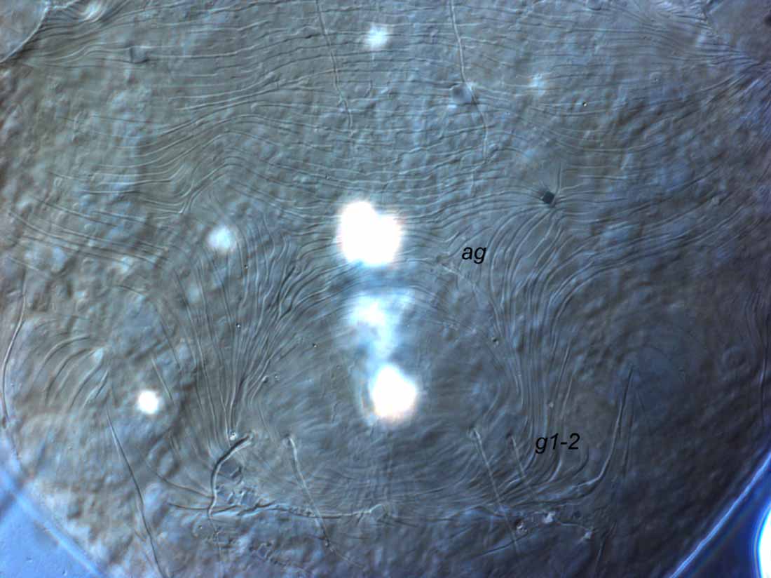            Fig. 6.   Coleacarus lithops  female posterior   venter.   