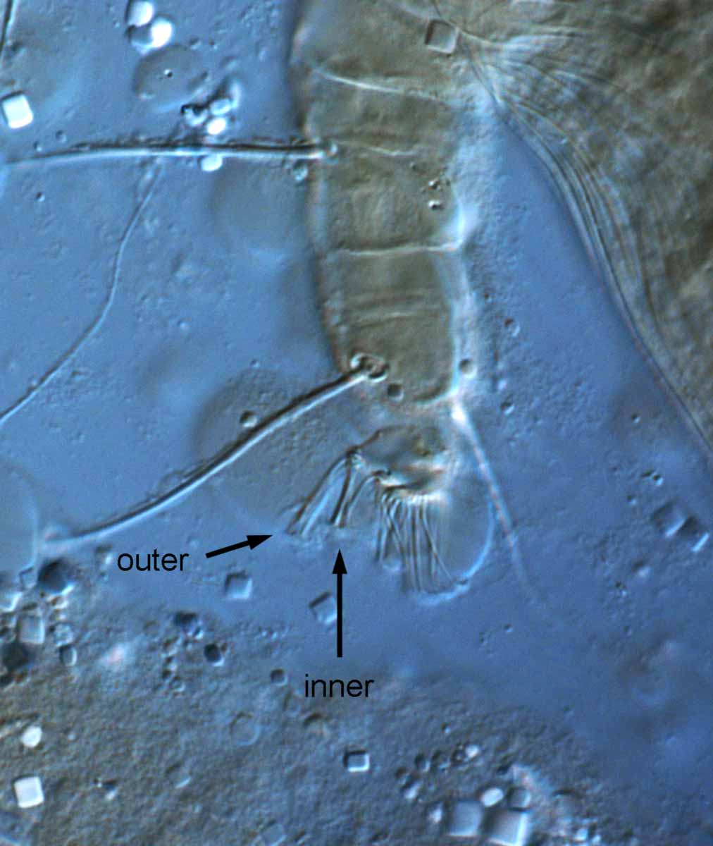            Fig. 7.   Coleacarus lithops  female tarsus   IV.   