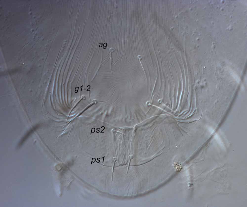            Fig. 5.   Crossipalpus   raveni  sp. nov.   Beard amp; Seeman female venter, with detail of genital   region.   
