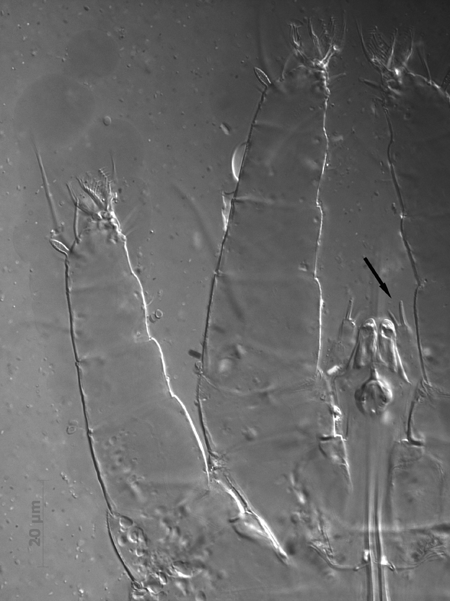   Fig. 9.  Dolichotetranychus floridanus  male palp, with arrow indicating the distal solenidion and eupathidium.
