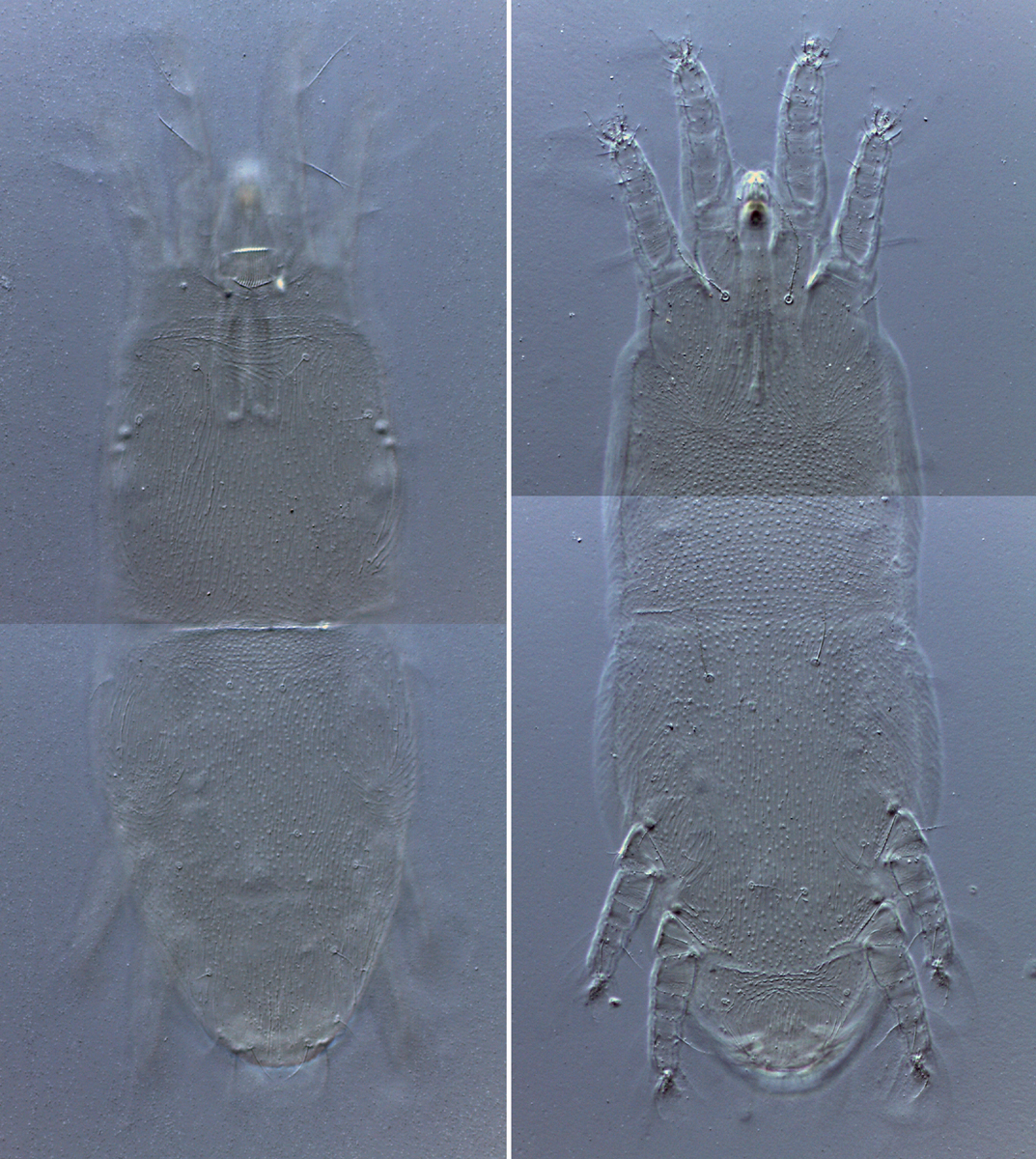            Fig. 1.  Dolichotetranychus  sp. female dorsum and   venter.   