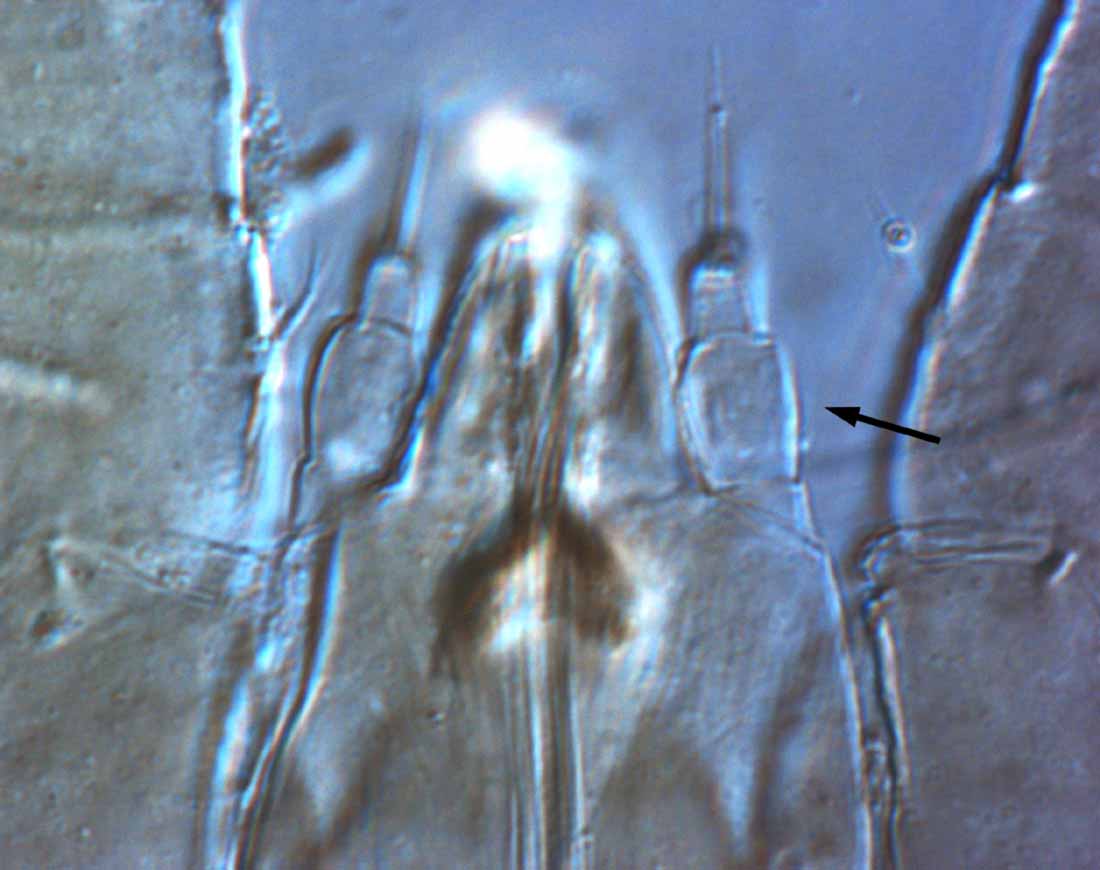            Fig. 10.   Dolichotetranychus floridanus    female, 3 segmented palps (indicated by arrow).   