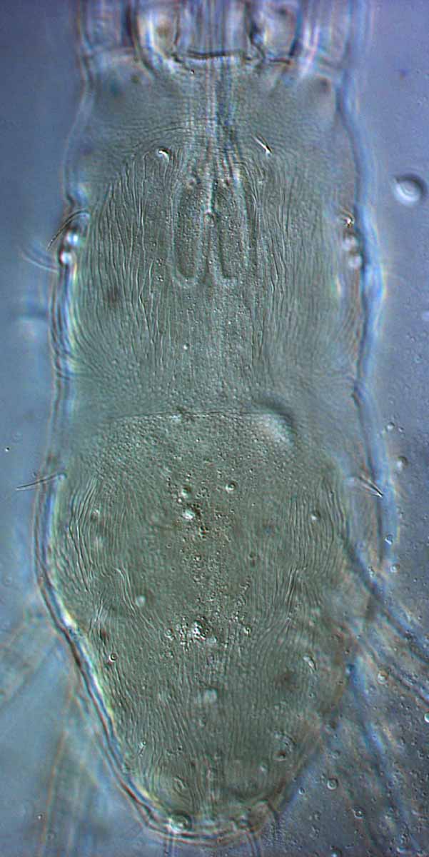            Fig. 6.   Dolichotetranychus floridanus  female   dorsum.   