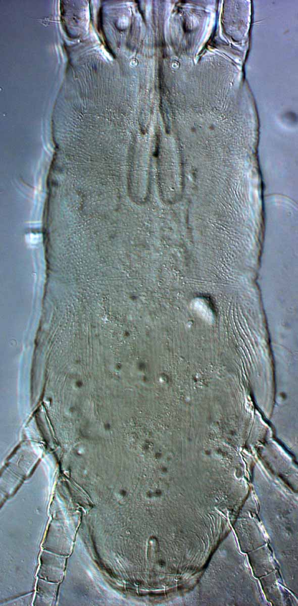            Fig. 8.   Dolichotetranychus floridanus  female   venter.   
