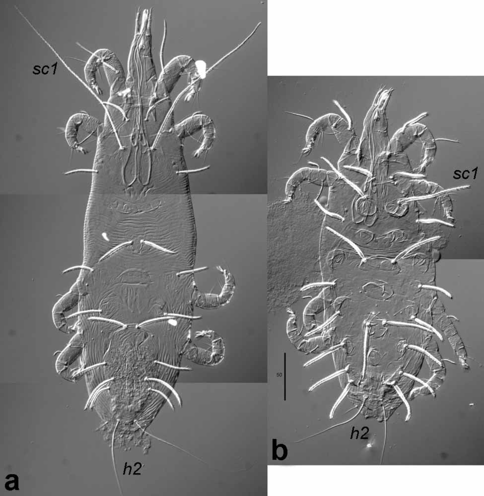            Fig. 3a.   Gahniacarus gersonus  female; 3b.     G. tuberculatus  female.   