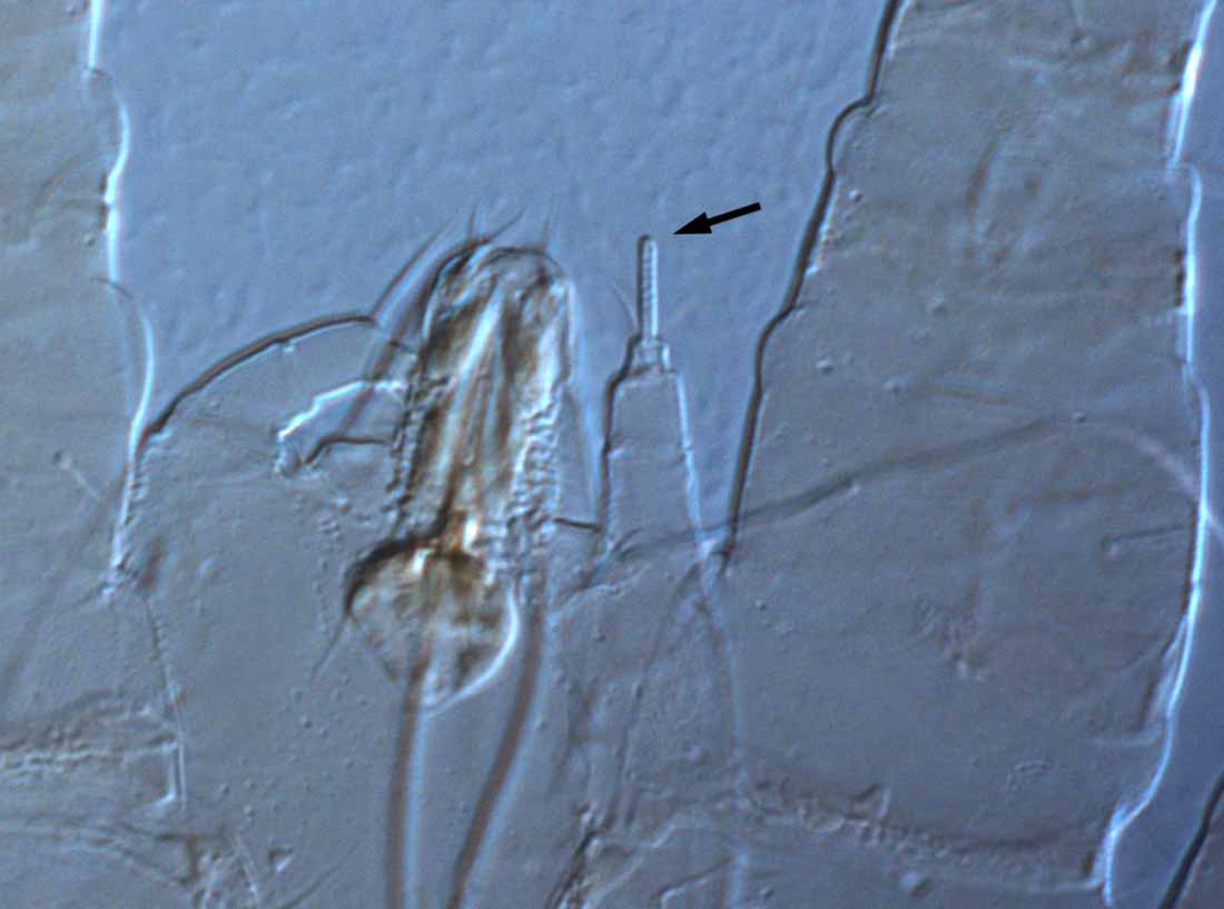            Fig. 4.   Macfarleniella queenslandica  female   palp tarsus (type).   