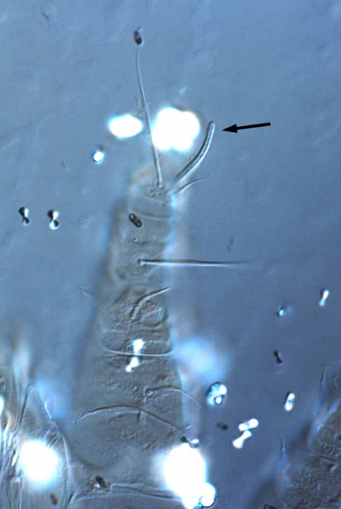            Fig. 5.   Macfarleniella queenslandica  female   tarsus I solenidion (type).   