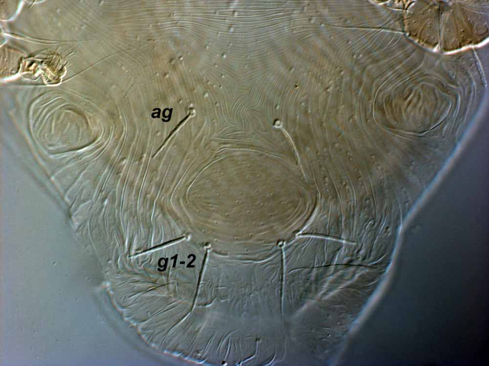            Fig. 10.   Pentamerismus   wardo  sp.   nov. Seeman amp; Beard, female venter, with detail of genital region   ( ps  setae obscured by extruded oviduct).   