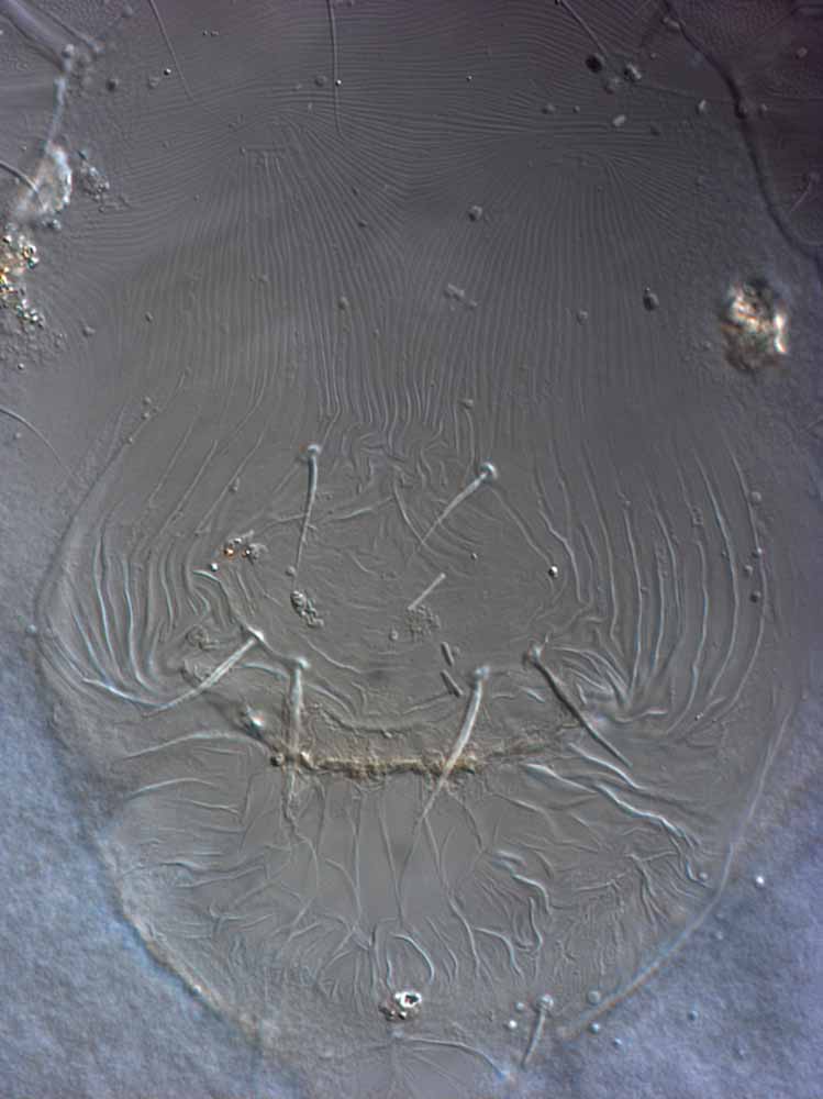            Fig. 5.   Philippipalpus agohoi  female venter,   with detail of genital region ( ps3  visible; oviduct extruded, obscuring    ps1-2 ) (type specimen).   